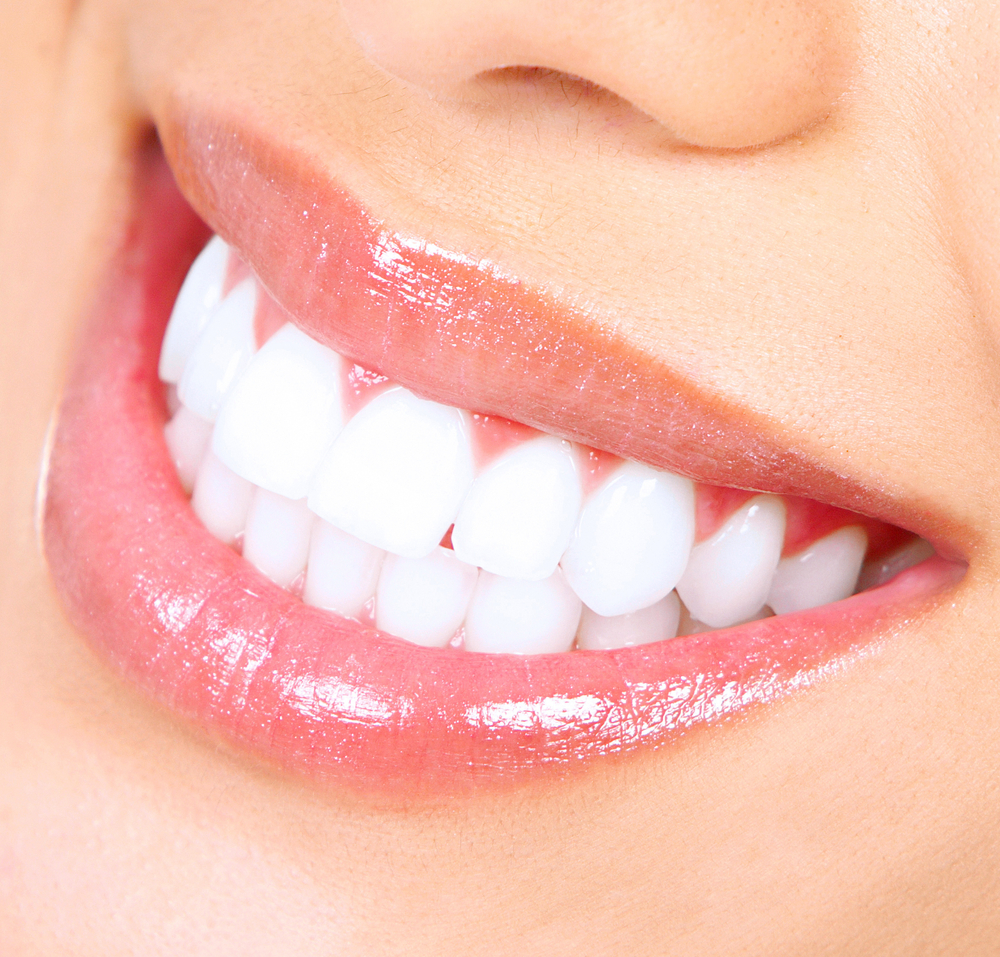 Tooth Whitening In Bangalore